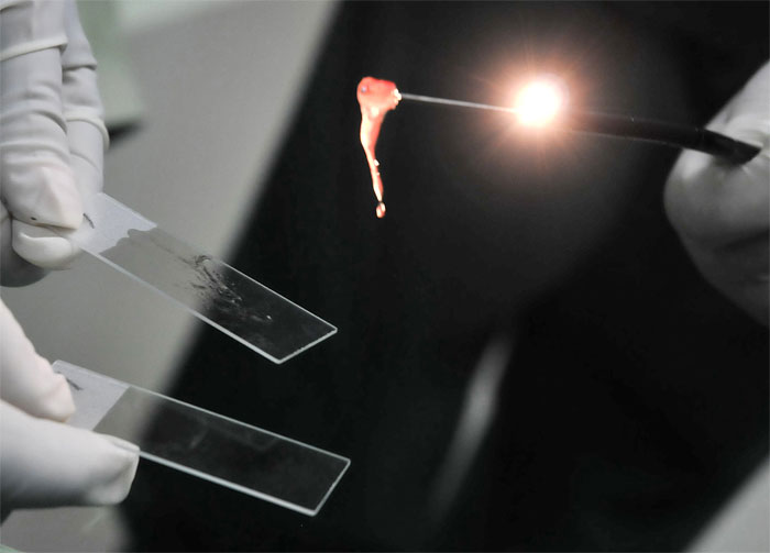 broncoscopia hospital3