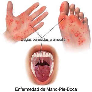 gráfico prevención