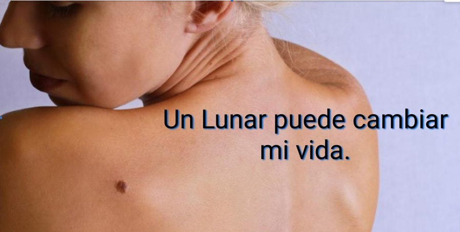 Un lunar
