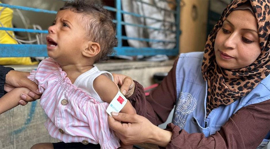 gaza ninos desnutricion jul25