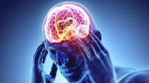 accidentes cerebrovasculares