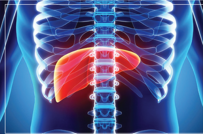 hepatitis
