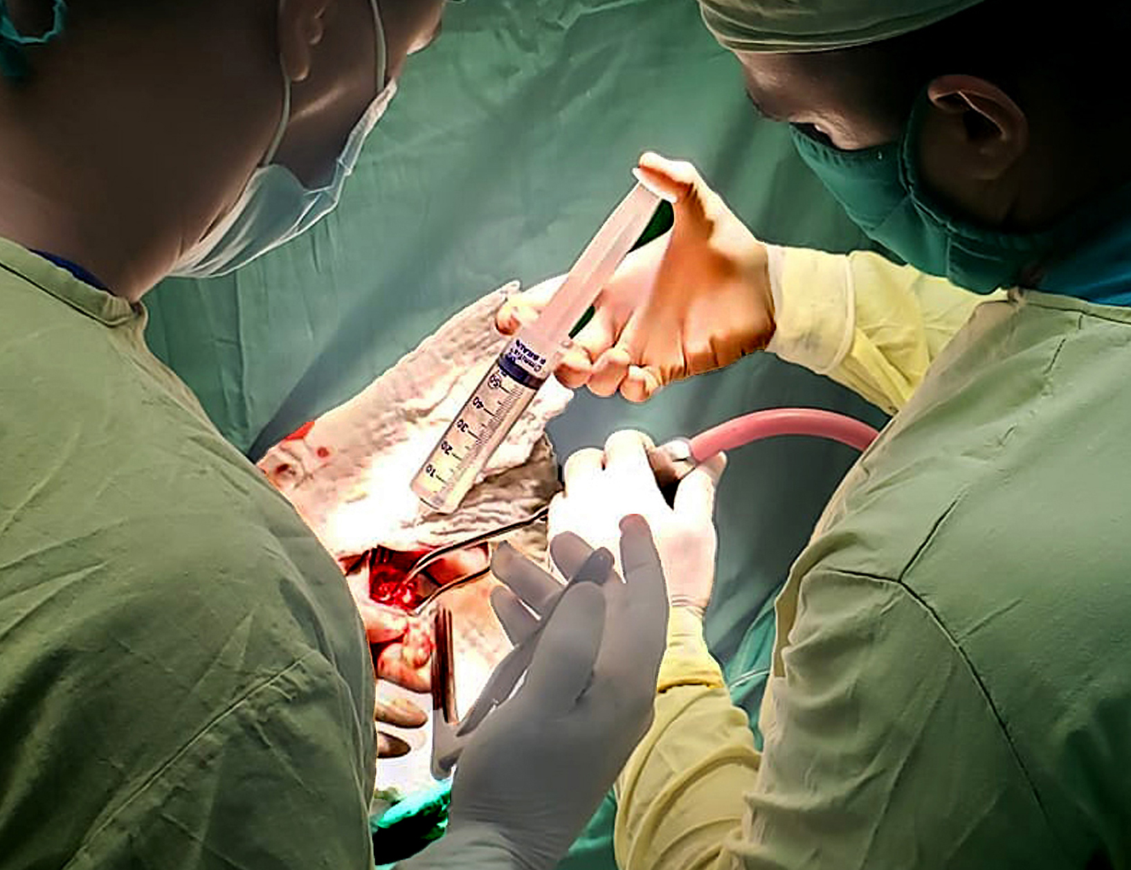 operacion neurocirugia