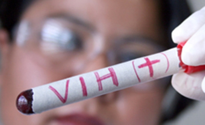 VIH-salud-guantanamo-cuba