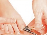 Tratamiento adecuado de las uñas